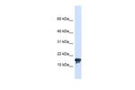 TMEM166 Polyclonal Antibody