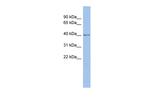SPOPL Antibody in Western Blot (WB)
