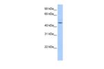 ZNF829 Polyclonal Antibody