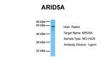 ARID5A Antibody in Western Blot (WB)