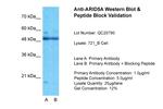 ARID5A Antibody in Western Blot (WB)