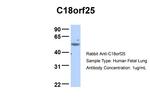 C18orf25 Antibody in Western Blot (WB)