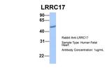 LRRC17 Antibody in Western Blot (WB)