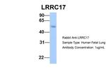 LRRC17 Antibody in Western Blot (WB)