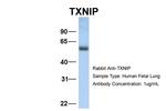 TXNIP Antibody in Western Blot (WB)