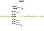 TXNIP Polyclonal Antibody