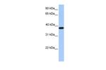 ACTRT2 Polyclonal Antibody