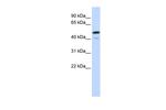 SPATA2L Polyclonal Antibody