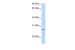 GRPEL2 Polyclonal Antibody