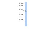 C10orf46 Polyclonal Antibody