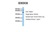 EXOC8 Polyclonal Antibody