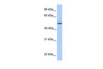 NHEDC2 Polyclonal Antibody