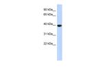 Aurora C Polyclonal Antibody