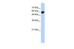 LRRC6 Polyclonal Antibody