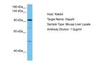 HSPA4L Polyclonal Antibody
