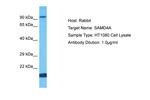 SAMD4A Polyclonal Antibody