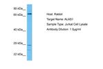 ALAS1 Antibody in Western Blot (WB)