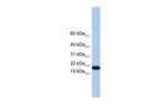 IL-5 Polyclonal Antibody