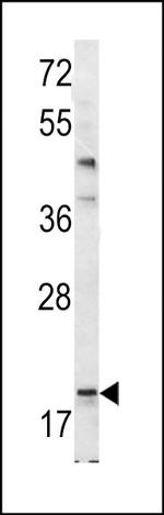 BAD Antibody in Western Blot (WB)