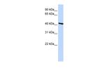 TMOD3 Polyclonal Antibody