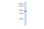 GPD1L Polyclonal Antibody