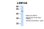 LSM14A Polyclonal Antibody