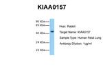 FAM175B Polyclonal Antibody