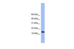 ATP5D Polyclonal Antibody