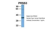 PRSS3 Polyclonal Antibody