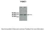 PSMC1 Polyclonal Antibody