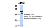 SEPT11 Antibody in Western Blot (WB)