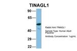 TINAGL1 Polyclonal Antibody