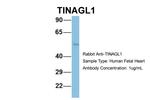 TINAGL1 Antibody in Western Blot (WB)