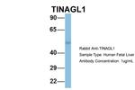 TINAGL1 Antibody in Western Blot (WB)