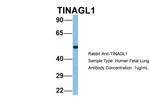 TINAGL1 Antibody in Western Blot (WB)