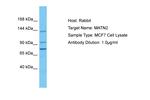 MATN2 Polyclonal Antibody