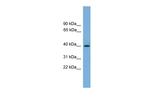 SERPINB8 Polyclonal Antibody