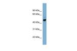ONECUT2 Polyclonal Antibody