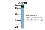 C2orf3 Antibody in Western Blot (WB)