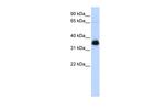 AIP Polyclonal Antibody