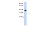 CDK1 Antibody in Western Blot (WB)