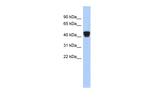 ERP44 Polyclonal Antibody