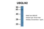 Ubiquilin 2 Polyclonal Antibody