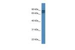 KLHL22 Polyclonal Antibody