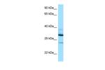 DOHH Polyclonal Antibody