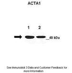 ACTA1 Antibody in Western Blot (WB)
