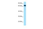 HSPA1A Antibody in Western Blot (WB)