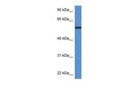 PGM5 Polyclonal Antibody