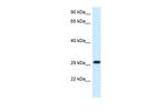 MRPL19 Antibody in Western Blot (WB)