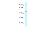 CHI3L2 Polyclonal Antibody